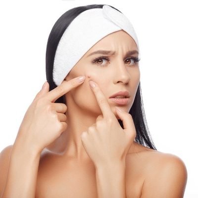 Acne facial Glendale CA