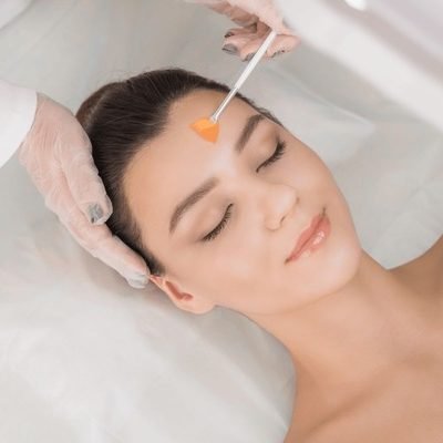 chemical peels Glendale California